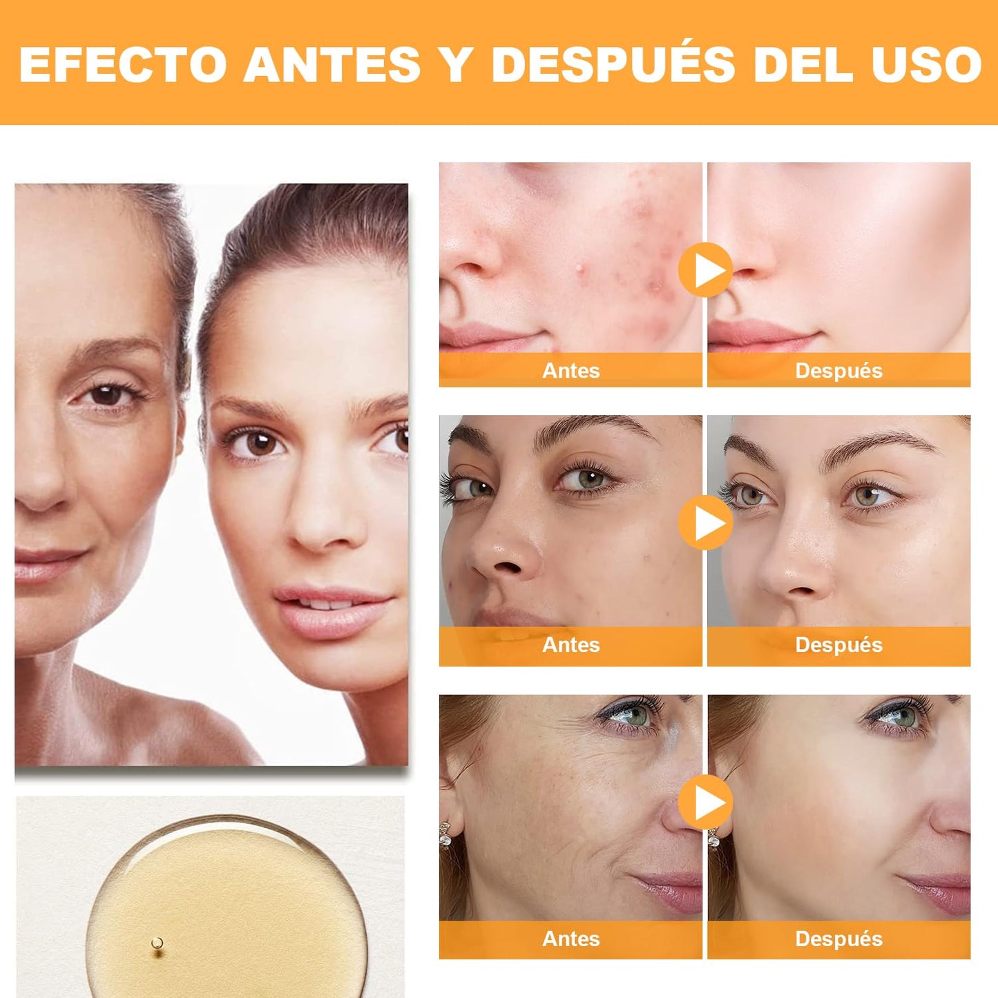 Ácido Glicólico 7% Solución, Exfolia, 240 ml